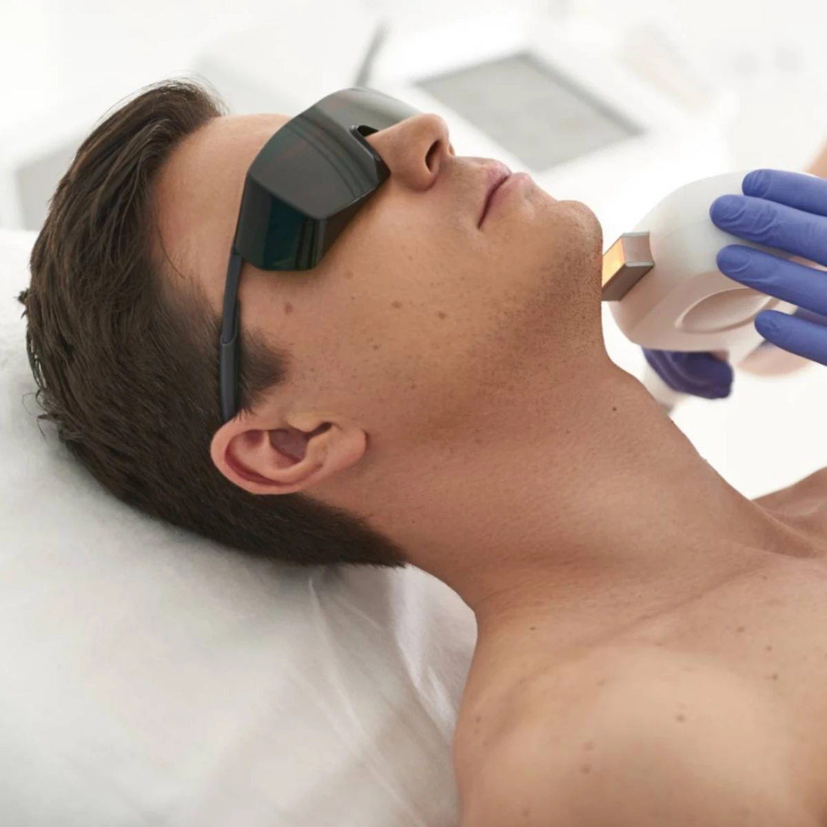 A laser session to define the chin or armpit